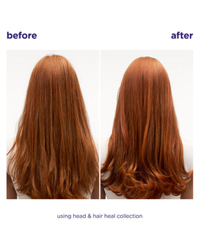 Head & Hair Heal Shampoo